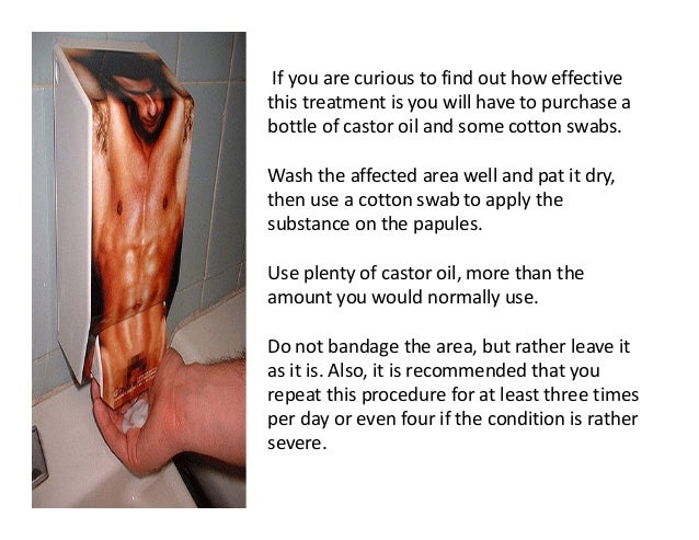 Pearly Oil Penile To Use Castor Papules How For Pearly Oil Penile To Use Castor Papules How For